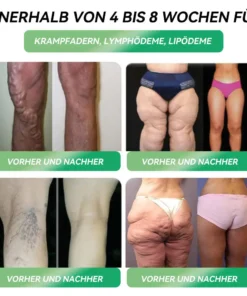 𝐒𝐓𝐃𝐄𝐈® 𝐆𝐋𝐏-𝟏 𝐒𝗹𝐢𝐦𝐦𝐢𝐧𝐠 & 𝐇𝐞𝐚𝗹𝐭𝐡 𝐈𝐦𝐩𝐫𝐨𝐯𝐞𝐦𝐞𝐧𝐭 𝐀𝐦𝐩𝐨𝐮𝗹𝐞 𝐃𝐫𝐨𝐩𝐬
