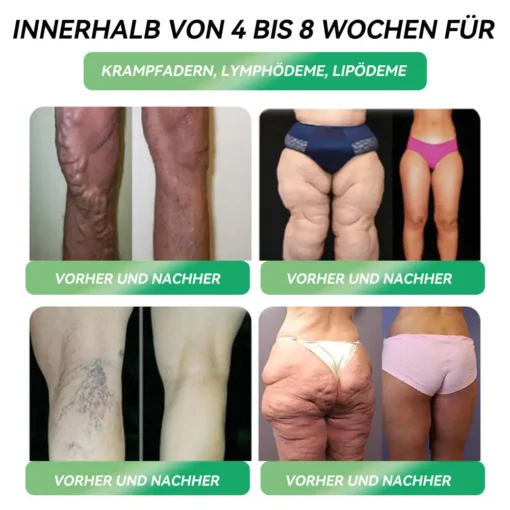 𝐒𝐓𝐃𝐄𝐈® 𝐆𝐋𝐏-𝟏 𝐒𝗹𝐢𝐦𝐦𝐢𝐧𝐠 & 𝐇𝐞𝐚𝗹𝐭𝐡 𝐈𝐦𝐩𝐫𝐨𝐯𝐞𝐦𝐞𝐧𝐭 𝐀𝐦𝐩𝐨𝐮𝗹𝐞 𝐃𝐫𝐨𝐩𝐬