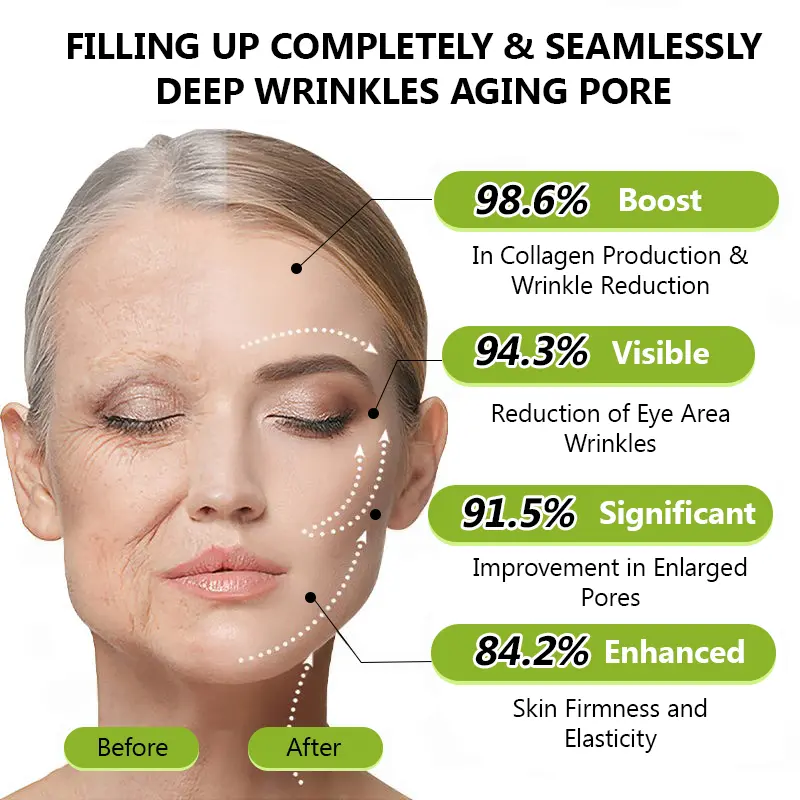 STDEI® BOTOX & VITA A RETINOL SHOT Wrinkle Lift Tightening Cream