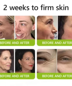 STDEI® BOTOX & VITA A RETINOL SHOT Wrinkle Lift Tightening Cream