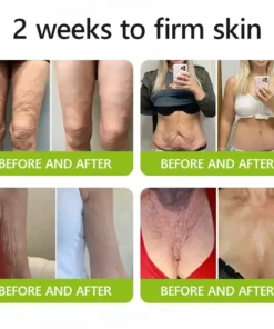 STDEI® BOTOX & VITA A RETINOL SHOT Wrinkle Lift Tightening Cream