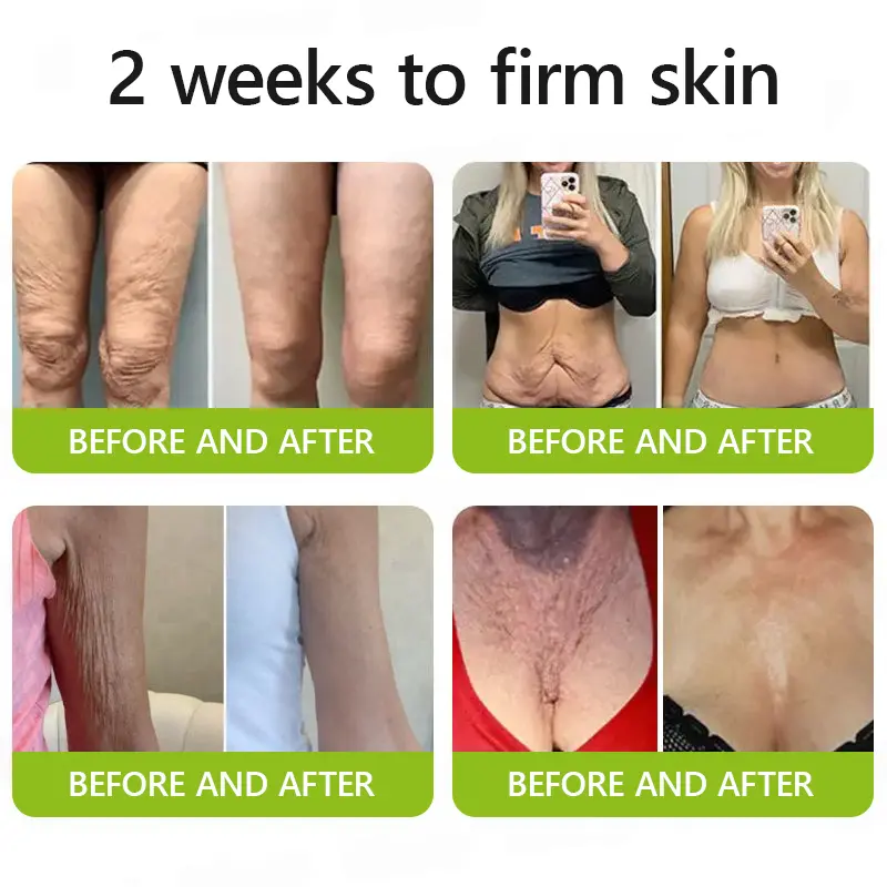 STDEI® BOTOX & VITA A RETINOL SHOT Wrinkle Lift Tightening Cream