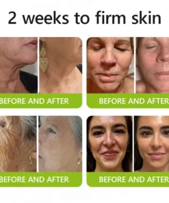 STDEI® BOTOX & VITA A RETINOL SHOT Wrinkle Lift Tightening Cream